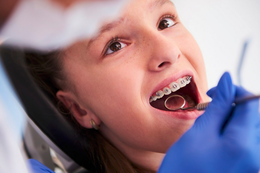 Ortodoncia en Quito — tratamiento con brackets Dra. Ana Arévalo