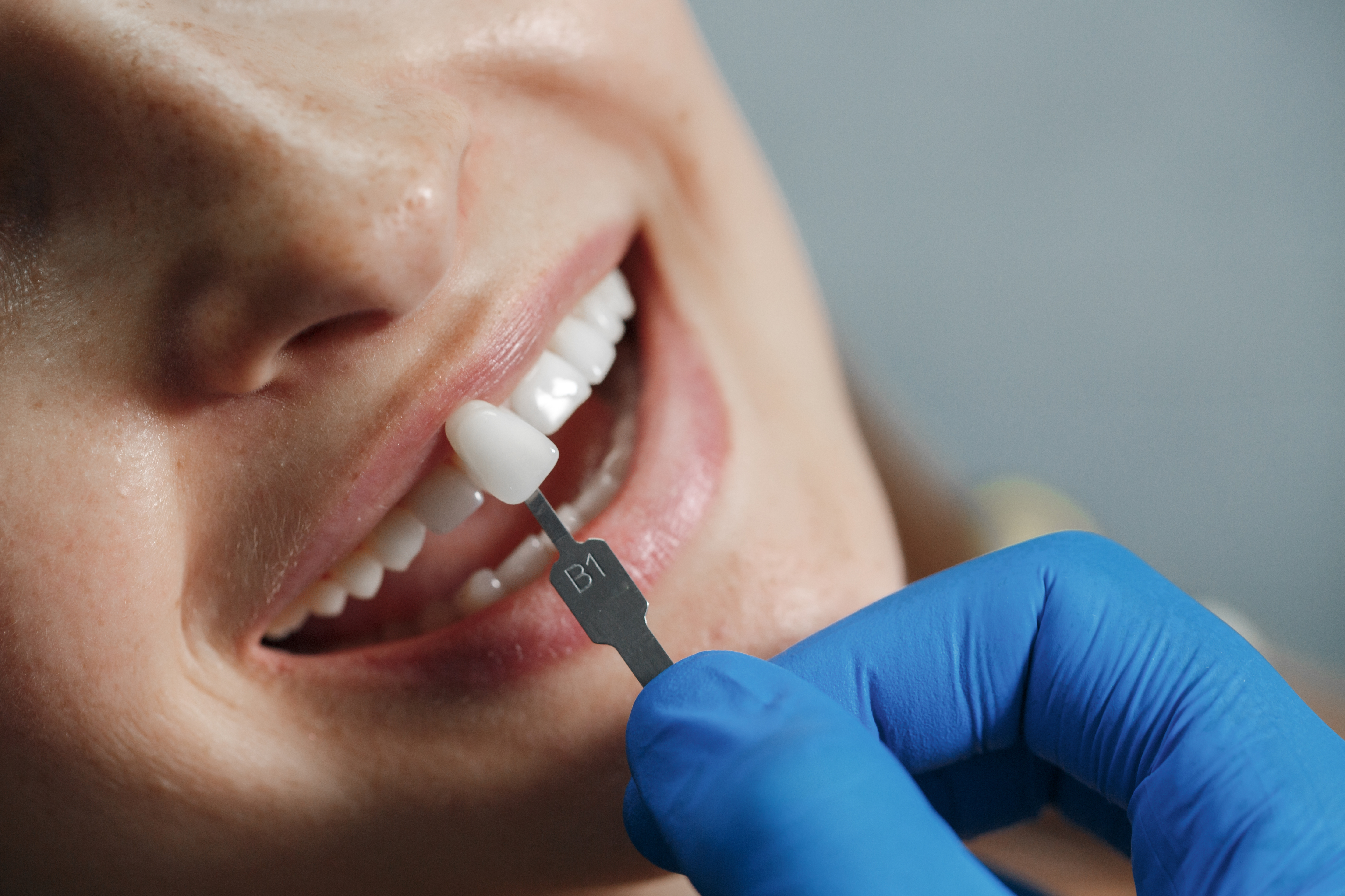 Implante dental en Quito — Dra. Ana Arévalo